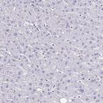 BCAT2 Antibody in Immunohistochemistry (IHC)