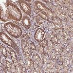 B3GALT5 Antibody in Immunohistochemistry (Paraffin) (IHC (P))