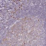 ZBTB6 Antibody in Immunohistochemistry (Paraffin) (IHC (P))