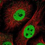 TLE3 Antibody in Immunocytochemistry (ICC/IF)