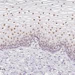 TLE3 Antibody in Immunohistochemistry (IHC)