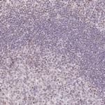 TLE3 Antibody in Immunohistochemistry (IHC)