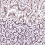 TLE3 Antibody in Immunohistochemistry (IHC)