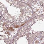 CCDC93 Antibody in Immunohistochemistry (IHC)