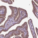 CCDC93 Antibody in Immunohistochemistry (IHC)