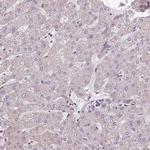 CCDC93 Antibody in Immunohistochemistry (IHC)