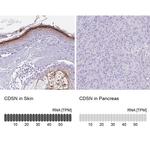 CDSN Antibody in Immunohistochemistry (IHC)