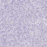 CDSN Antibody in Immunohistochemistry (IHC)