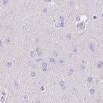 CDSN Antibody in Immunohistochemistry (IHC)