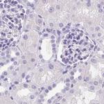 CDSN Antibody in Immunohistochemistry (IHC)