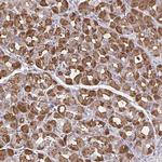 MDH1 Antibody in Immunohistochemistry (Paraffin) (IHC (P))