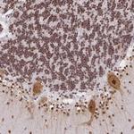 NDUFAB1 Antibody in Immunohistochemistry (Paraffin) (IHC (P))