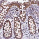 IL-37 Antibody in Immunohistochemistry (Paraffin) (IHC (P))