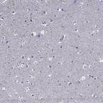 Spectrin beta-4 Antibody in Immunohistochemistry (IHC)