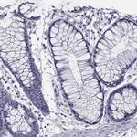 Spectrin beta-4 Antibody in Immunohistochemistry (IHC)