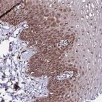 PIN4 Antibody in Immunohistochemistry (Paraffin) (IHC (P))