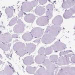 CCDC151 Antibody in Immunohistochemistry (Paraffin) (IHC (P))