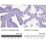 CCDC151 Antibody in Immunohistochemistry (IHC)