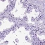 CCDC151 Antibody in Immunohistochemistry (IHC)