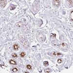 IRX2 Antibody in Immunohistochemistry (IHC)