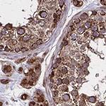 NFS1 Antibody in Immunohistochemistry (IHC)