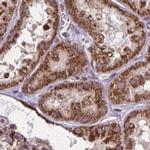 NFS1 Antibody in Immunohistochemistry (IHC)