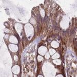 NFS1 Antibody in Immunohistochemistry (IHC)