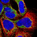 NDUFAF2 Antibody in Immunocytochemistry (ICC/IF)