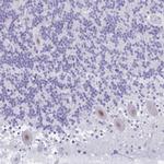 GLB1L2 Antibody in Immunohistochemistry (Paraffin) (IHC (P))