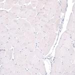 PTPRK Antibody in Immunohistochemistry (IHC)