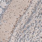 PTPRD Antibody in Immunohistochemistry (Paraffin) (IHC (P))