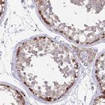 PTPRD Antibody in Immunohistochemistry (IHC)