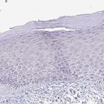 PTPRD Antibody in Immunohistochemistry (IHC)