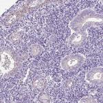 Desmoplakin Antibody in Immunohistochemistry (Paraffin) (IHC (P))