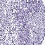 Desmoplakin Antibody in Immunohistochemistry (Paraffin) (IHC (P))