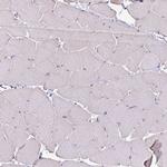 Desmoplakin Antibody in Immunohistochemistry (IHC)