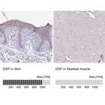 Desmoplakin Antibody