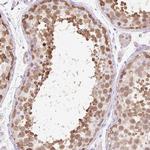 ZNF121 Antibody in Immunohistochemistry (Paraffin) (IHC (P))