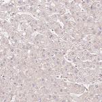 SLC29A3 Antibody in Immunohistochemistry (Paraffin) (IHC (P))