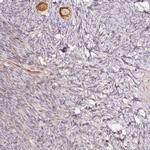 SLC29A3 Antibody in Immunohistochemistry (IHC)