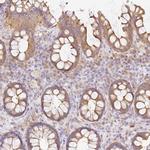 DENND5A Antibody in Immunohistochemistry (IHC)