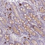 LHFPL5 Antibody in Immunohistochemistry (Paraffin) (IHC (P))