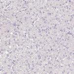 LHFPL5 Antibody in Immunohistochemistry (Paraffin) (IHC (P))