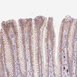 LHFPL5 Antibody in Immunohistochemistry (Paraffin) (IHC (P))