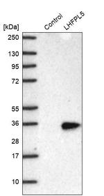 LHFPL5 Antibody in Western Blot (WB)