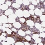 APOBEC3D Antibody in Immunohistochemistry (Paraffin) (IHC (P))