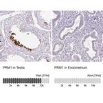 PRM1 Antibody in Immunohistochemistry (IHC)