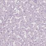 PRM1 Antibody in Immunohistochemistry (IHC)