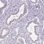 PRM1 Antibody in Immunohistochemistry (IHC)