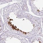 PRM1 Antibody in Immunohistochemistry (IHC)